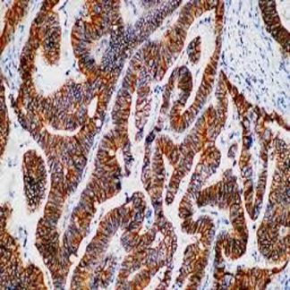 🇬🇧 β-Catenin Antibody (Immunohistochemistry)