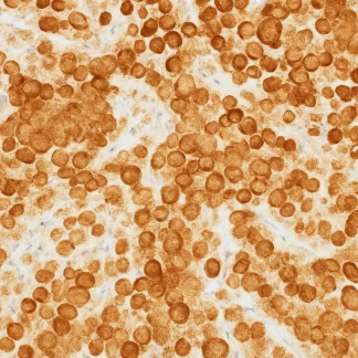 🇬🇧 HMB-45 Antibody (Immunohistochemistry)