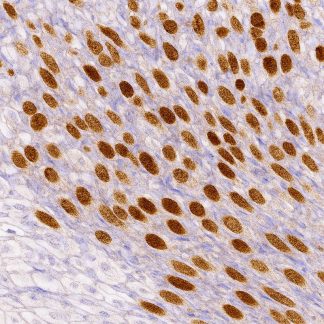 Glypican-3 Antibody (Immunohistochemistry)